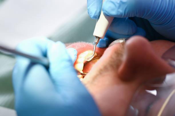 Best Emergency Broken Tooth Repair in White Castle, LA